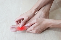 Gout: Painful Arthritis Caused by Uric Acid Crystals