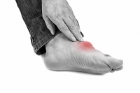 Risk Factors That Make Gout More Likely