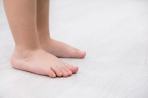 Causes and Managing of Flat Feet in Children
