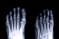 The Complex Elegance of the Human Foot