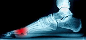 The Purpose of the Sesamoid Bones